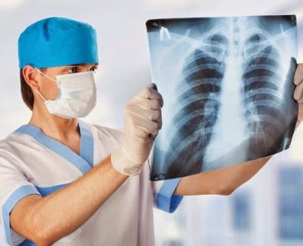 В Украине провели итоговую рабочую встречу экспертов по противодействию туберкулезу