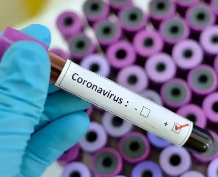 Первый случай коронавируса подтвердили в Украине