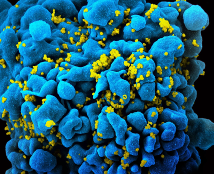 Препарат клітинної терапії допоможе знищити ВІЛ силами організму пацієнта