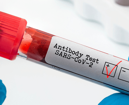 Минздрав утверждает, что наличие антител к вирусу Sars-Cov-2 не может быть причиной для отказа от противоковидной прививки. /osdhealthcare.co.uk