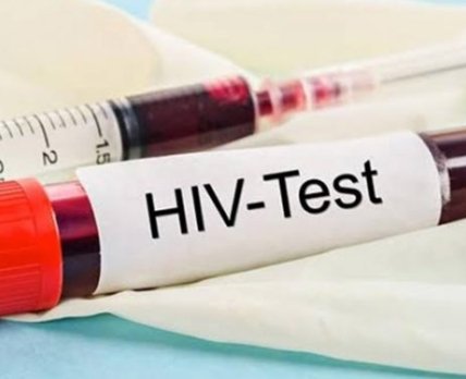В Україні оновили алгоритм тестування на ВІЛ-інфекцію /ghstandard.com