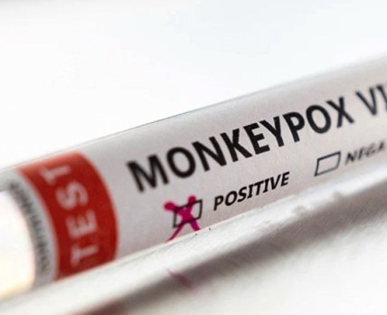 monkeypox /Reuters