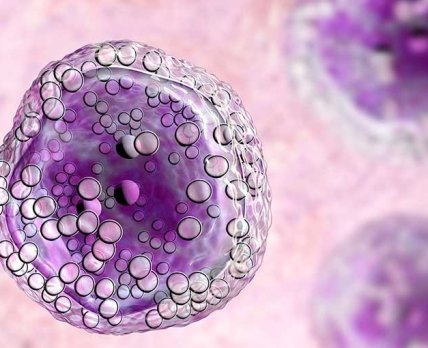 Eli Lilly наближається до реєстрації Jaypirca в першій лінії терапії лімфоми