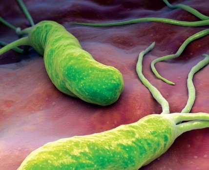 Новый вариант лечения Helicobacter pylori: поможет короткий курс из всего двух препаратов