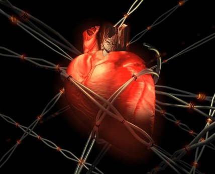 Во Франции врачи наблюдают за третьим пациентом с искусственным сердцем Carmat