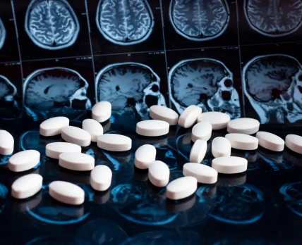 Препарат від хвороби Альцгеймера відмовилися визнати «проривною терапією»