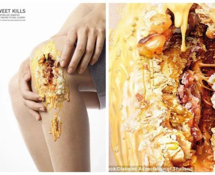 «Sweet Kills»: о последствиях диабета предупредили раны от сладостей
