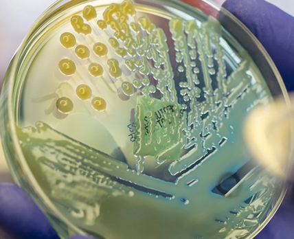 GSK лицензирует инновационный антибиотик