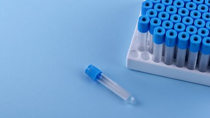 Кабмін затвердив нові вимоги до медичних виробів та виробів для діагностики in vitro /Magnific