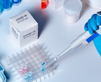 Гослекслужба осуществит проверку отечественных производителей тест-систем на COVID-19