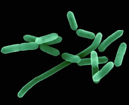 Листериоз убил волынянина. Как уберечься от опасной инфекции /sciencephoto.com