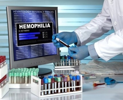 Экспериментальное средство генной терапии гемофилии помогло еще двум пациентам