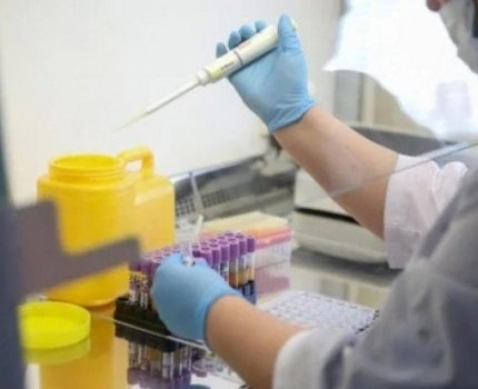 В Украине запустят серийное производство собственных тестов для выявления COVID-19