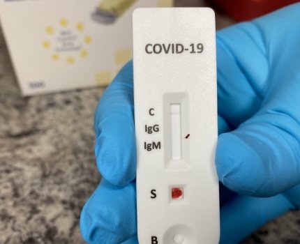 Насколько точны серологические тесты на Covid-19?