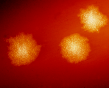 Антибиотик Crestone излечивает инфекции Clostridioides difficile лучше, чем ванкомицин /wikipedia.org
