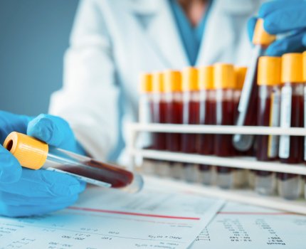 Препарат против гемофилии от Pfizer и Sangamo может повторить судьбу кандидата Biomarin