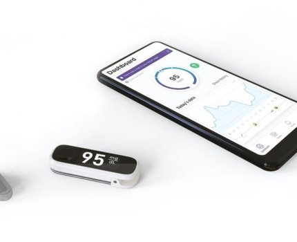 Indigo Diabetes разработает невидимый сенсор глюкозы