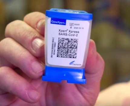 FDA утвердило новый экспресс-тест на коронавирус со временем ожидания 45 минут