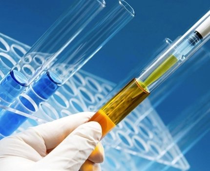 Противодиабетический препарат, от которого открестилась Sanofi, впечатлил клиницистов