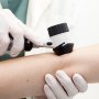 Скрининг меланомы: новый консенсус внесет больше ясности