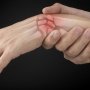 Препарату от «хрустальной болезни» дадут второй шанс