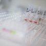 Novartis зацікавилася лікуванням серповидно-клітинної анемії