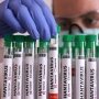 Хантавирус Andes не представляет высокого риска для Украины — Центр общественного здоровья Минздрава /reuters
