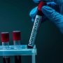 Для боротьби з COVID-19: у Північній Кореї мобілізували понад 1 млн медиків