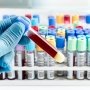 Високочутливий тропонін дає перевагу в діагностиці гострого інфаркту міокарда