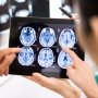 Дослідники пропонують новий варіант лікування розсіяного склерозу — відофлудимус кальцію