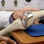 Минздрав ввел электронную очередь на эндопротезирование: пациенты будут получать протезы бесплатно /Depositphotos