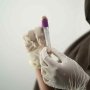 Ученые разработают тест на «долгий» COVID-19