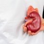 ЄС затвердив пероральний препарат проти вовчакового нефриту