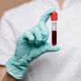 Исследование: у пациентов с рассеянным склерозом нужно отслеживать концентрации витаминов группы B /freepik