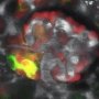 Macula densa изображена жолто-зеленый пятном