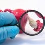 Новые международные рекомендации по оценке и лечению синдрома поликистозных яичников (СПКЯ)