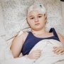 13-летняя София после операции в НДСЛ «Охматдет». Фото: МОЗ /Facebook
