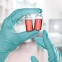 Комбинация онкопрепаратов от Merck и Eisai подтвердила эффективность при раке эндометрия