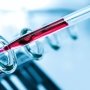 FDA одобрило первый анализ крови на вирус Зика для рутинного использования