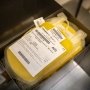 МОЗ анонсувало роботу системи донорства крові «єКров»