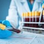 Україна отримала власні версії американських CDC