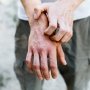 Pfizer гейміфікує терапію атопічного дерматиту