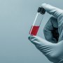 CDC розслідував випадки зараження туберкульозом серед медпрацівників, які контактували з інфікованими пацієнтами