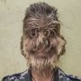 Некачественное лекарство стало причиной развития гипертрихоза у 16 детей в Испании