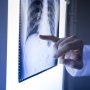 Профіль безпеки ліків від діабету: у фокусі – ризики переломів