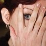 Дерматологи рекомендуют изучать при разработке плана лечения все фенотипы розацеа