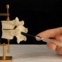 Низкодозовая гипобарическая анестезия при эндопротезировании суставов: мепивакаин сравнили с бупивакаином