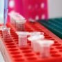 Профессора медицины обвиняют в подтасовке клинических данных. Спонсор подставил учёного?