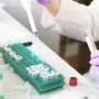 Определена наиболее эффективная терапевтическая стратегия при гепатите С