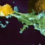 Раскрыт потенциал имбиря в терапии аутоиммунных заболеваний